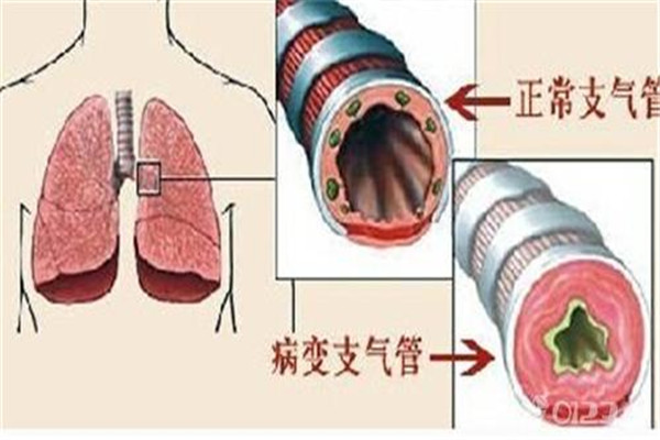 气管疼痛是什么原因图片